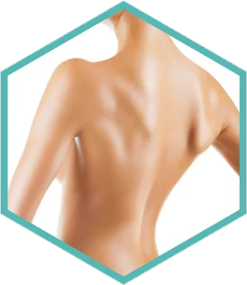 Lumecca IPL photofacial London - hexagon crop of the back treatment area Hexagon crop of the back treatment area for Lumecca IPL photofacial in London